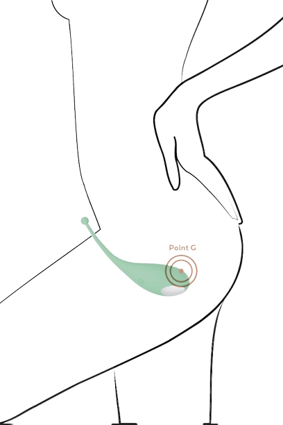 Palpitation - Adrien Lastic - Couleur au choix